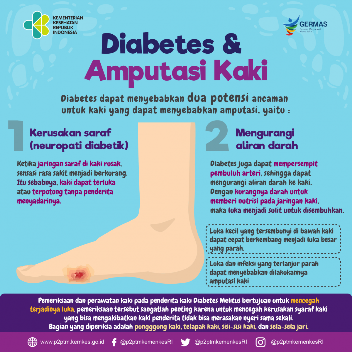 Mengapa Diabetes yang tidak terkontrol berpotensi menyebabkan amputasi kaki ?