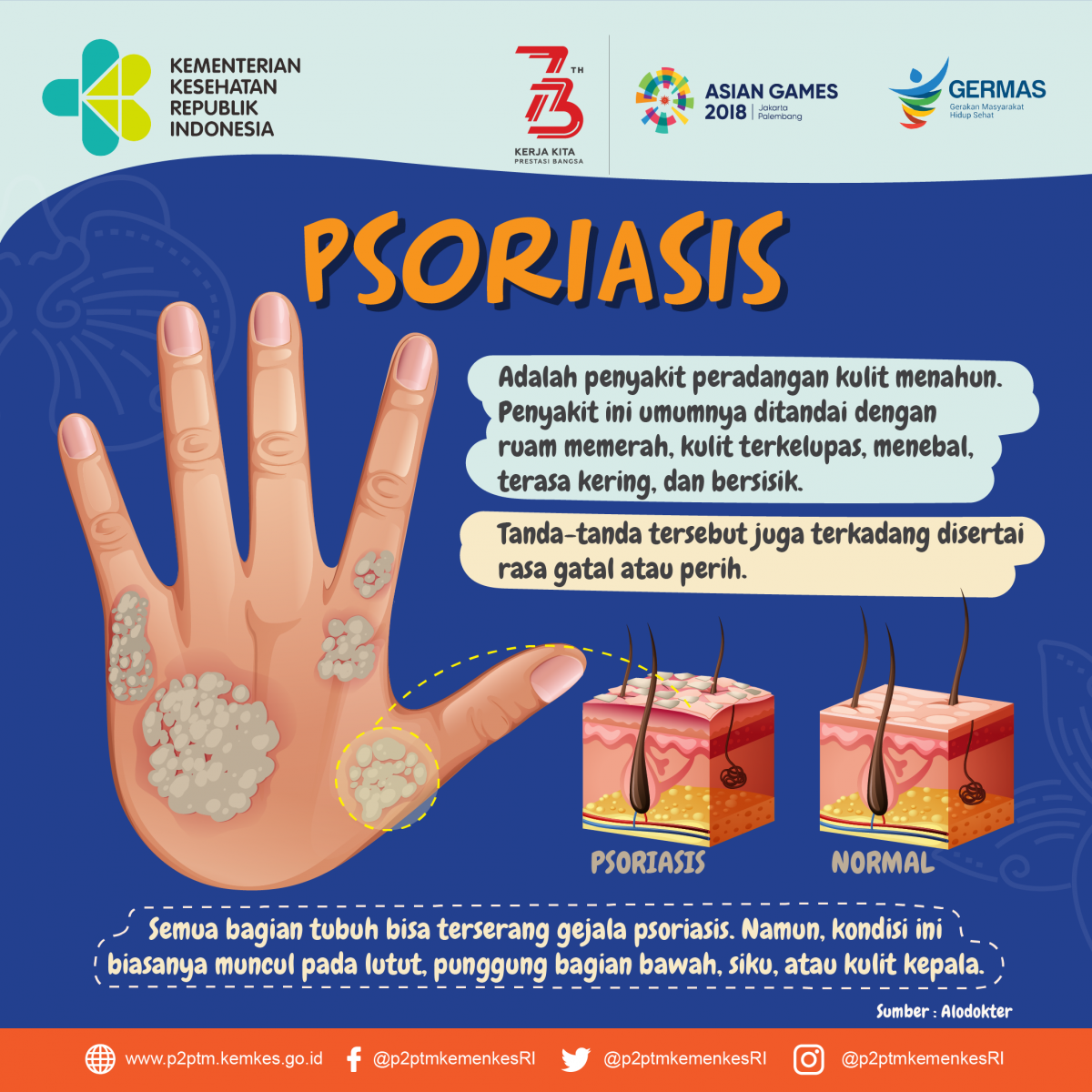 Psoriasis Porn