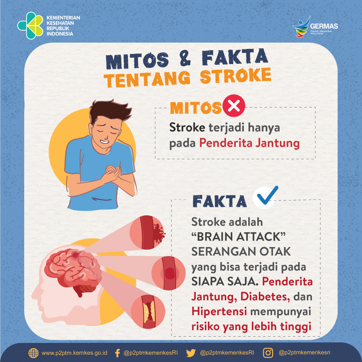  Mitos bahwa Stroke terjadi hanya pada penderita jantung? Yuk, simak faktanya.