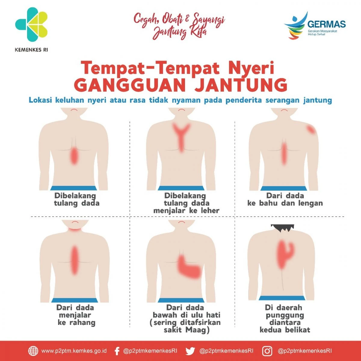 Tempat-Tempat Nyeri Pada Gangguan Jantung